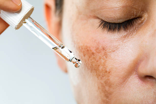 Best treatment for sun-damaged skin on face